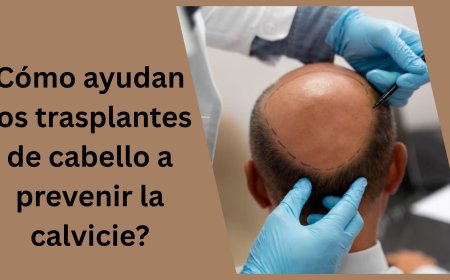 Cómo ayudan los trasplantes de cabello a prevenir la calvicie?