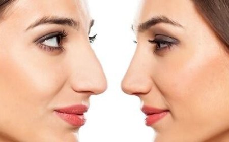 Discover the Art of Ethnic Rhinoplasty in NYC: Tailored Beauty with Cultural Respect