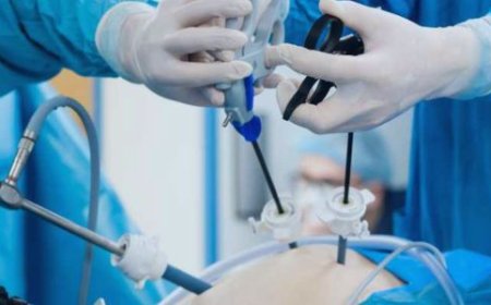 Difference Between Laparoscopy and Endoscopy: A Comprehensive Guide by Delhi’s Top Spine Specialist