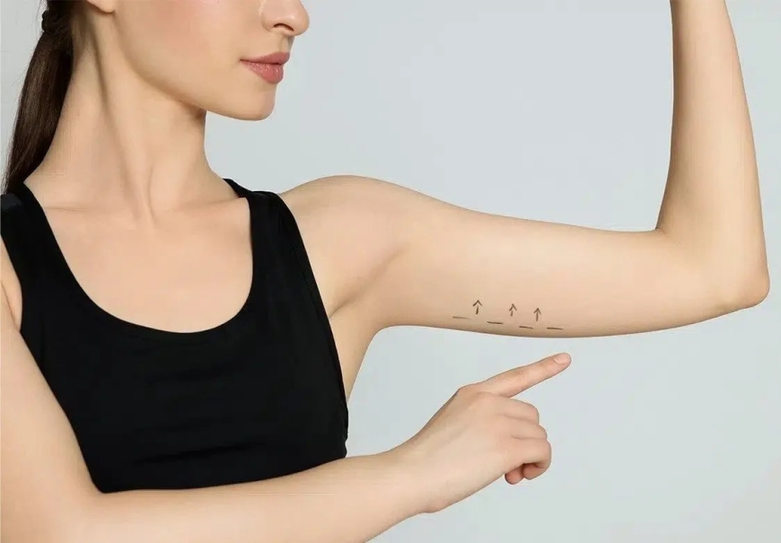 Arm Lift in Jeddah: Tone and Tighten for a More Defined Upper Body