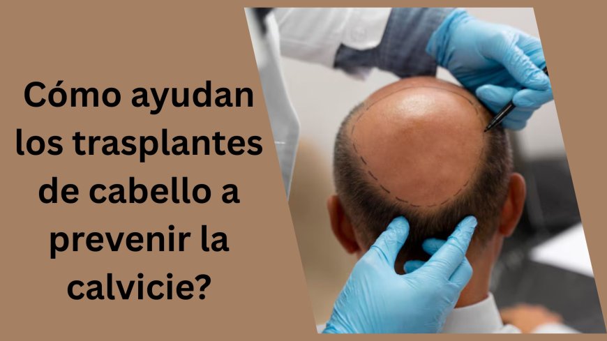 Cómo ayudan los trasplantes de cabello a prevenir la calvicie?