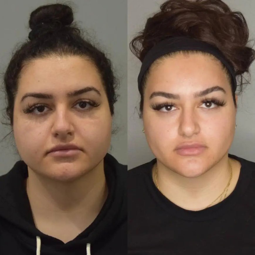 Is Buccal Fat Removal Surgery in Dubai Right for You?