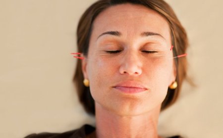 Acupuncture for Menopause Relief: A Natural Approach to Balance and Wellness