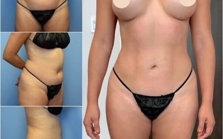 Why Body Contouring in Dubai Is a Game Changer for Your Confidence
